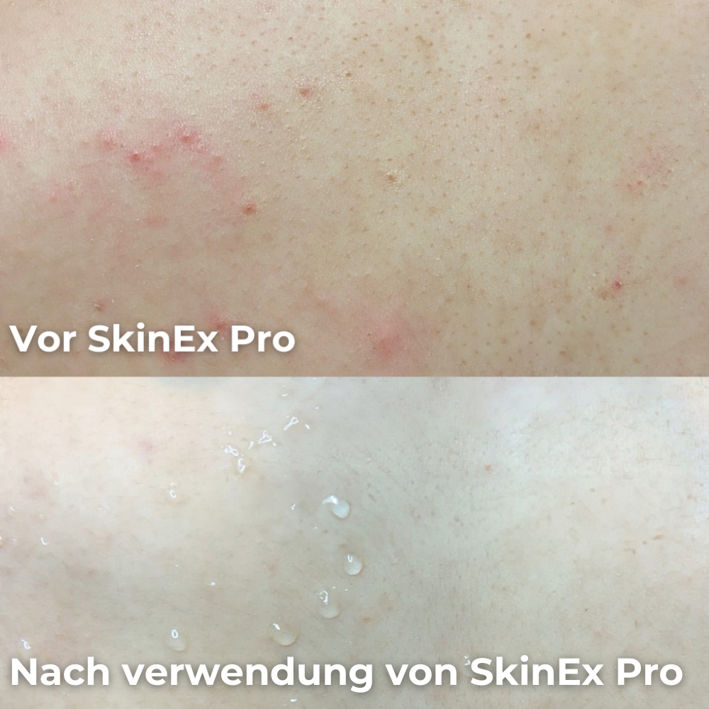SkinEx Pro